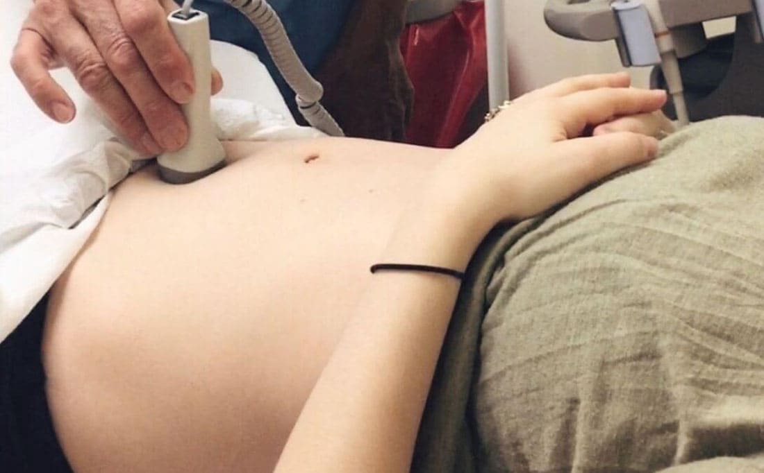 Increments fetal pulse, fetal pulse